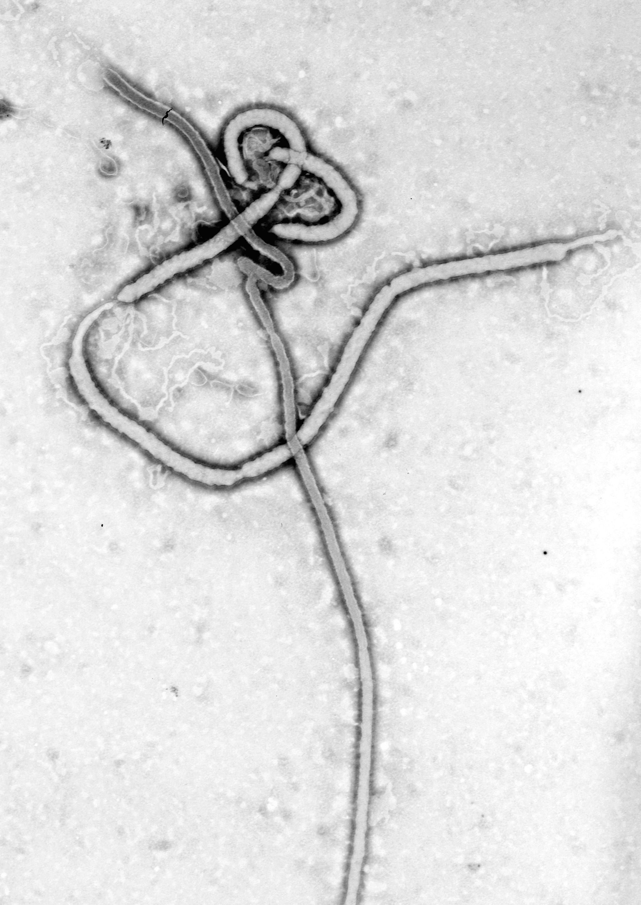Fọ́tò microscope àtijọ́ ti Zaire Ebola ní 1976 fún àlàyé. Kì í ṣe àpẹẹrẹ láti ọ̀dọ̀ àwọn tí a fura sí ní Nàìjíríà tàbí fọ́tò Bundibugyo. CDC / Dr. Frederick A. Murphy; public domain.